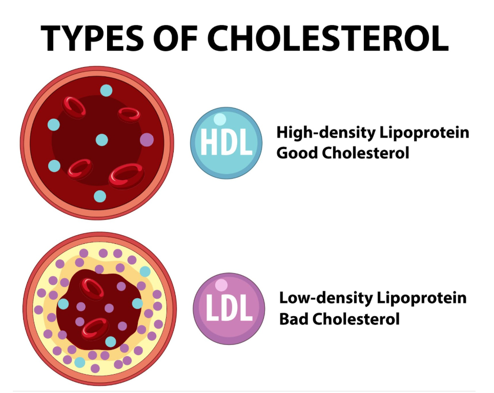 илюстративно изображение на добър и лош холестерол